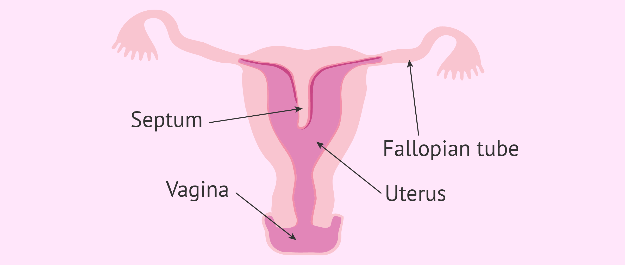 Uterine Septum Symptoms, Causes & Treatment in Kolkata